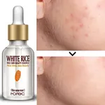 ROREC Rice vitamin c Serum Best For Pores & Moisturizing - 15ml – Thumbnail 2