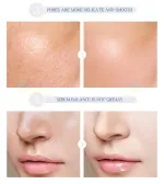 Laikou Korea Hyaluronic Acid Essence Serum-17ml – Thumbnail 3