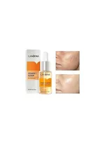 Lanbena Vitamin C Brightening Serum - 15Ml – Thumbnail 2