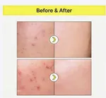 Tiam Vita B3 Source Niacinamide Skin Brightening Serum – Thumbnail 3