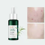 FENYI Tea Tree Acne Serum -17ml – Thumbnail 1