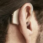 A&M XTM XP A4 BTE Hearing Aid for Severe to Profound Hearing Loss – Thumbnail 2
