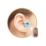 Siemens Vibe Mini 8 CIC Digital Programmable Hearing Aid – Thumbnail 3