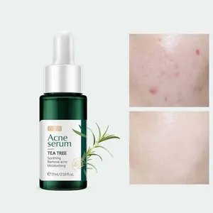 FENYI Tea Tree Acne Serum -17ml