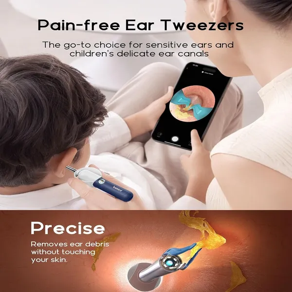 Bebird R37R Electric Ear Cleaning Camera Wax Removal Tool kit – Color: Blue – View 4