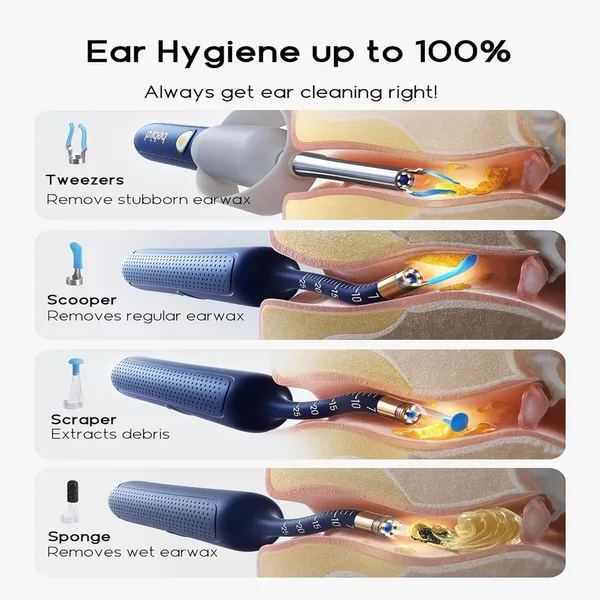 Bebird R37R Electric Ear Cleaning Camera Wax Removal Tool kit – Color: Blue – View 3