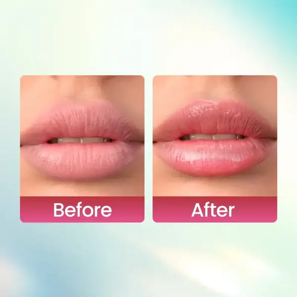 Swiss Beauty Kiss Beauty Alcohol Free Lip Balm Cherry – View 3