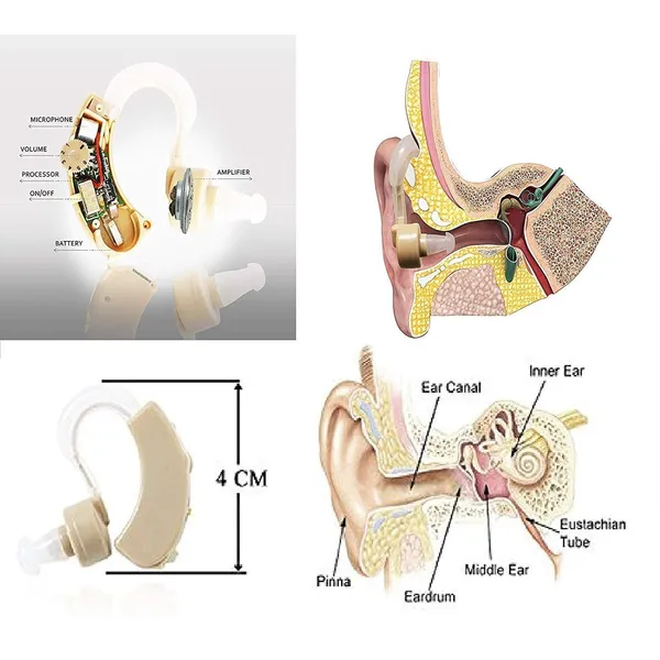 Sony S-115 Digital Sound High Technology Amplifier Hearing Aid – View 5
