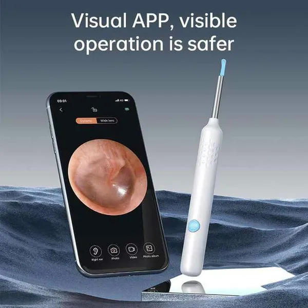 Smart Visual Electric Ear Cleaner Earpick Wax Removal Tool with Camera LED Light – Color: White – View 2
