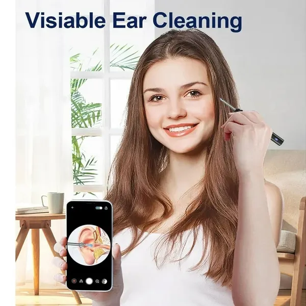 Smart Visual Electric Ear Cleaner Earpick Wax Removal Tool with Camera LED Light – Color: Black – View 3